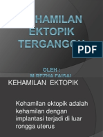 Kehamilan Ektopik