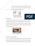 Teknik Vertikal