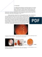 Uveitis (acil)