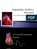 Isquemia PRESENTACION