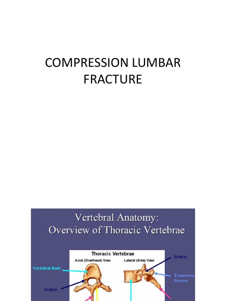 Compression Lumbar Fracture Kane Erni. PDF Vertebral Column