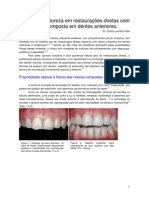 Imitando A Natureza em Restauracoes Dentes Anteriores