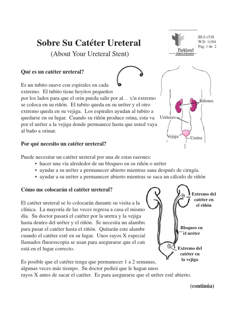 Sobre Tu Catéter Ureteral (Catéter Doble J) | PDF | Riñón | Vejiga urinaria