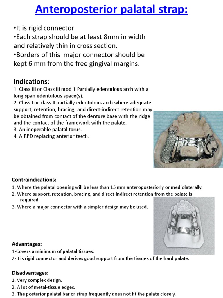 Anteroposterior Palatal Strap Overview | PDF
