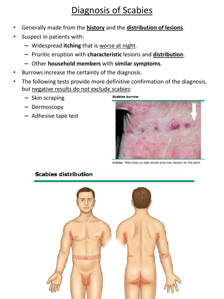 How To Diagnose Scabies | PDF