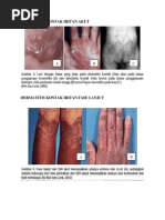 Download Gambar Dermatitis by Siska Dee SN140799465 doc pdf