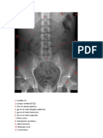 Laminas Abdomen