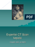 Download Expertisi CT Scan Kepala by Greisy Rivta SN141180974 doc pdf