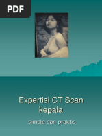 Download Expertisi CT Scan Kepala by Greisy Rivta SN141180974 doc pdf