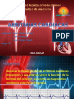 ARRITMIAS CARDIACAS