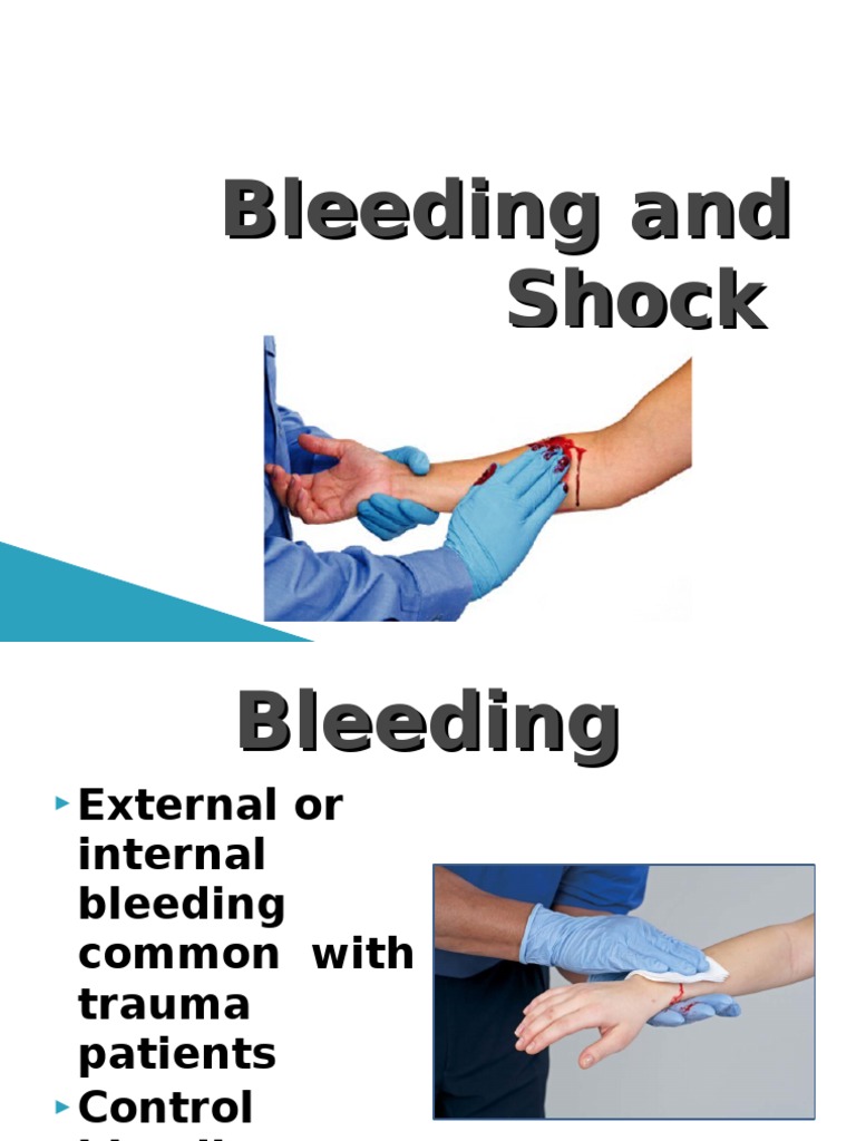 Bleeding Control and Shock Management Guide | PDF | Bleeding | Wound