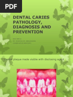 Dental Caries Pathology, Diagnosis and Prevention