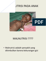 Penyuluhan - Malnutrisi Pada Anak