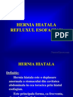 Hernie Hiatala Reflux Eso 2799563
