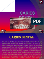 Caries Dental