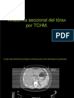 4.3 Anatomia Seccional Del Torax Por TCHM.