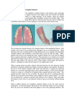 Repairing Fracture of Complete Dentures