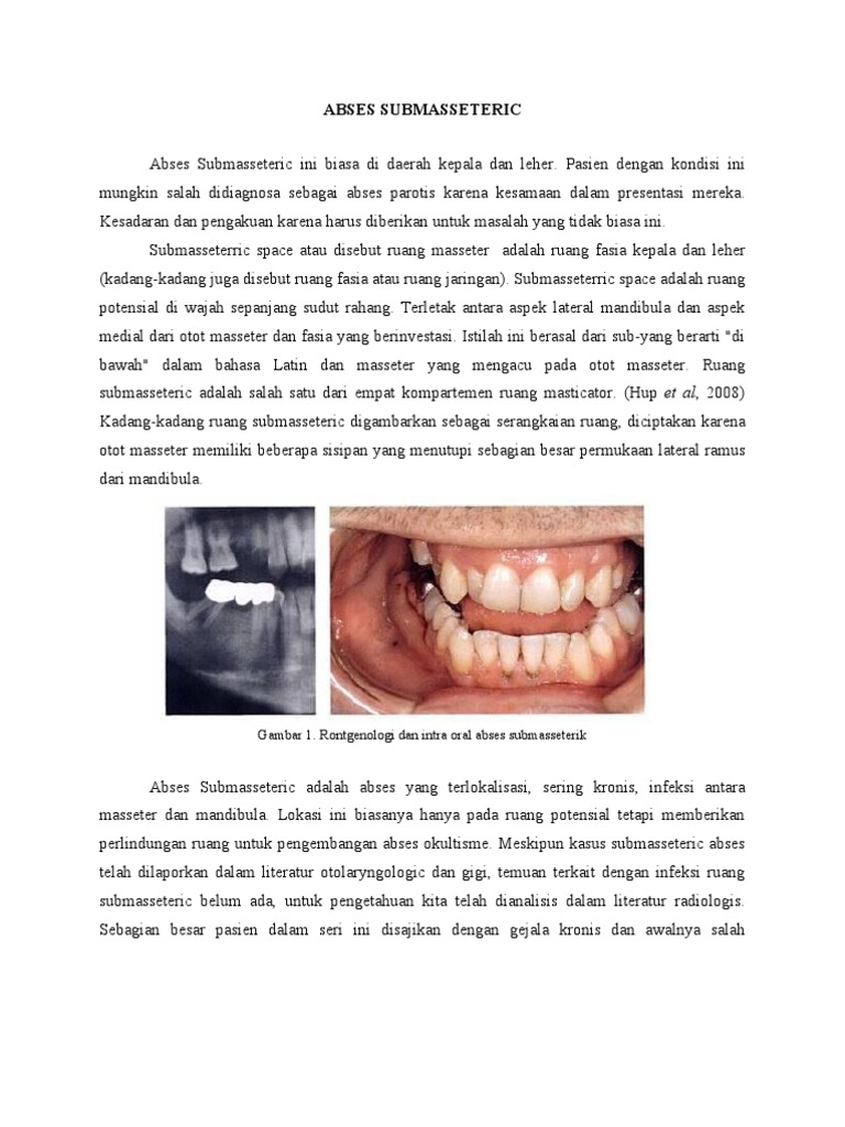 Abses Submasseterik: Gejala dan Penyebab | PDF