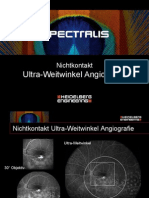 SPECTRALIS Ultra-Widefield Angiography