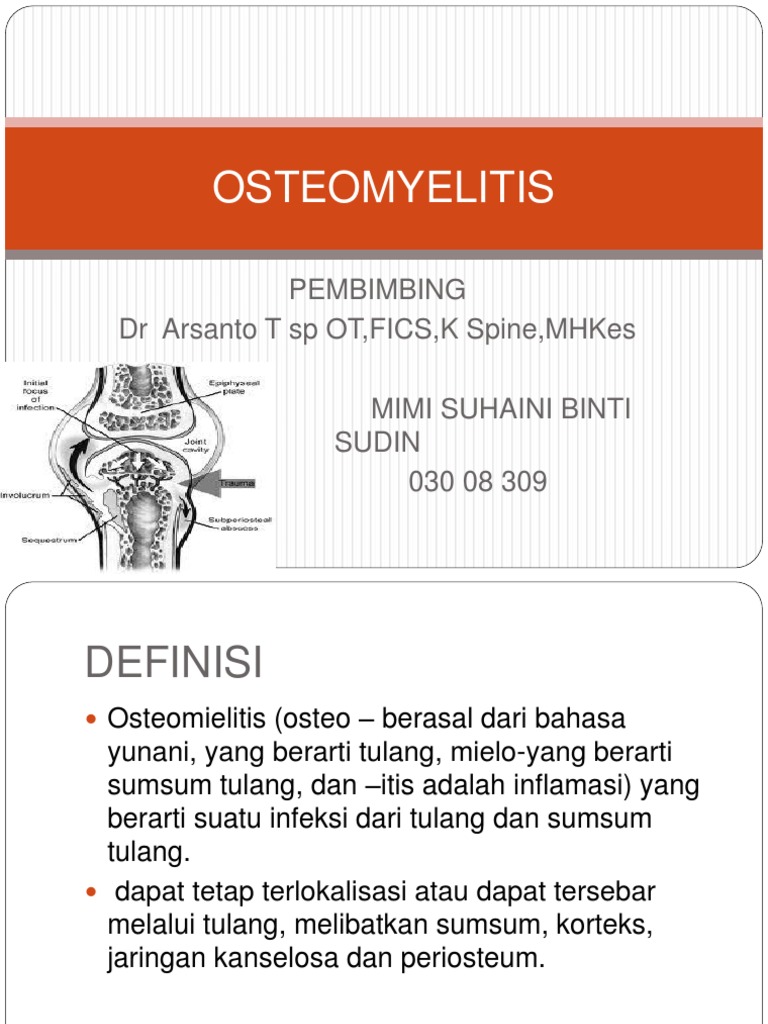 Osteomyelitis Ppt Jadi
