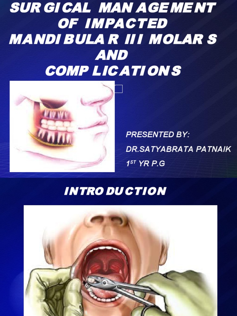 Surgical Management of Impacted Molars | PDF | Animal Anatomy | Human ...