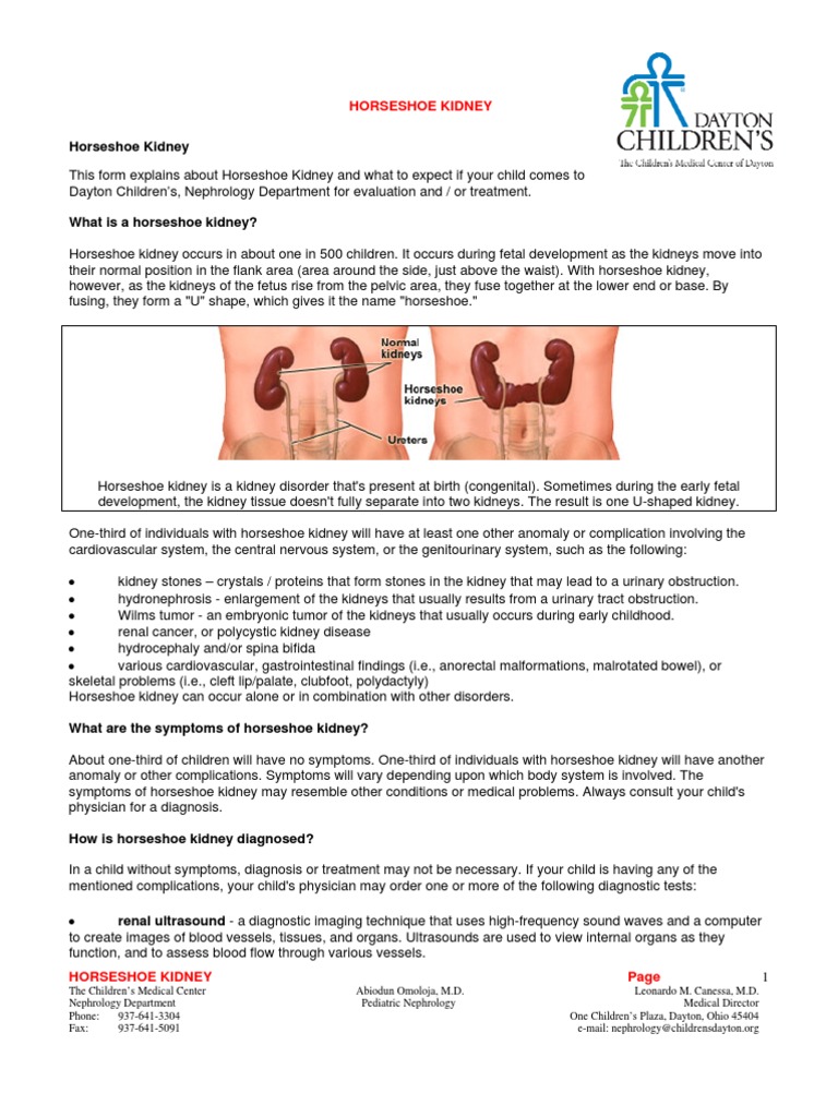 Complication of Horseshoe Kidney PDF Congenital Disorder Kidney
