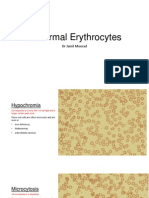 Abnormal Erythrocytes