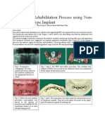 Full Mouth Rehabilitation Process Using Non-Submerged Type Implant[1]_14