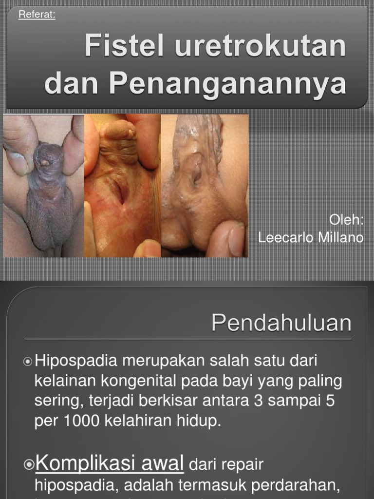 Kaifologist porno rasmlar