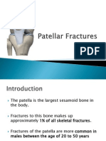 Patellar Fractures