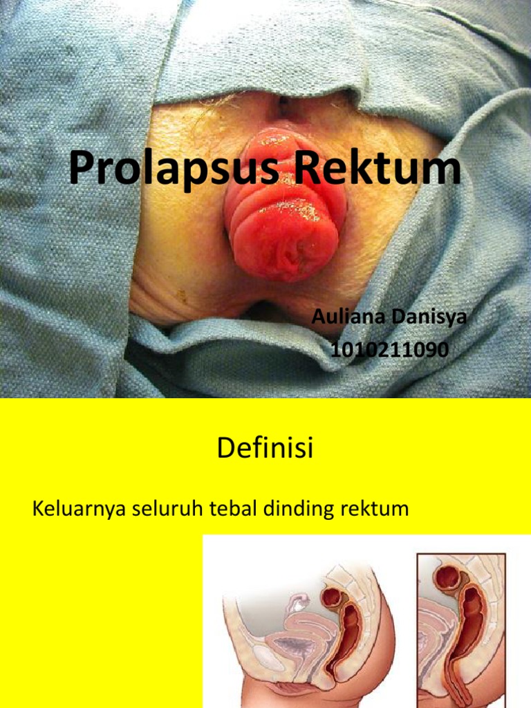 Qizi va dadam pornosini onlayn tomosha qiling