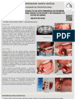 Cirurgia de Enucleação de Cisto Periapical em Paciente Heterozigoto para Mutação de Fator V de Coagulação (Fator de Leiden) - Relato de Caso
