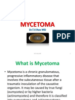 Mycetoma