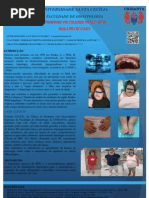 Síndrome de Prader Willi