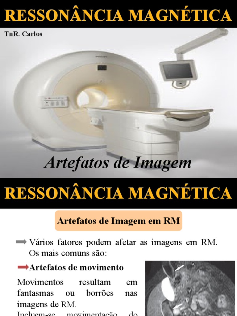 6 Artefatos De Imagem Em RM PDF Magnetismo Imagem De Resson ncia 