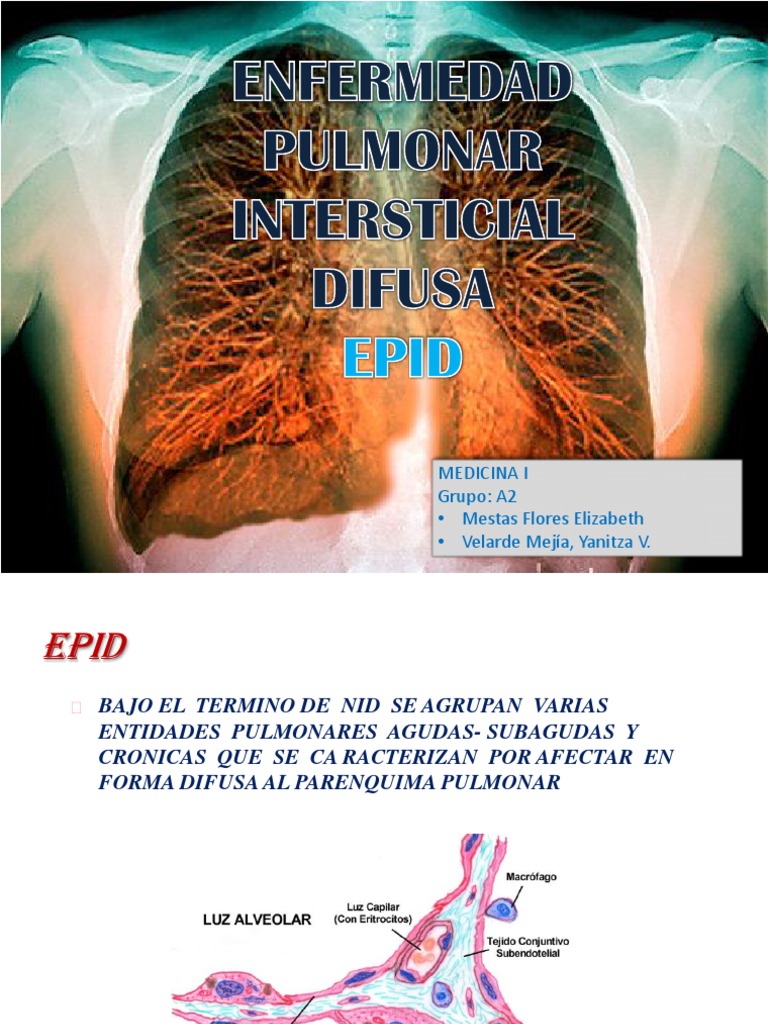 Enfermedades Pulmonares Intersticiales | PDF | Inflamación ...