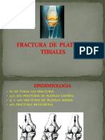 FX de Platillos Tibiales