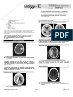4.neurology II Hemorrhagic Stroke 2014A