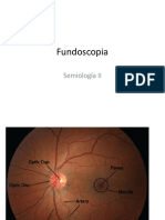 Fundoscopia