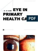 International Centre For Eye Health Teaching Set 2 The Eye in Primary Health Care