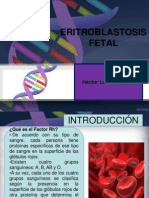 Eritoblastosis Fetal