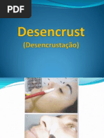 De Sen Crust