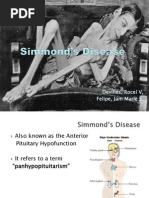 Simmond's Disease MS