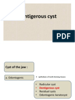 Dentigerous Cyst