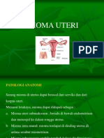 MIOMA UTERI