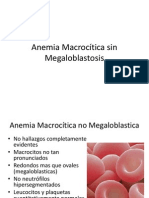 Anemia Macrocítica Sin Megaloblastosis