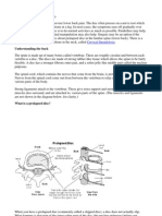 Prolapsed Disc