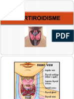 HIPERTIROID