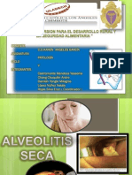 Alveolitis Seca