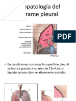 Derrame Pleural